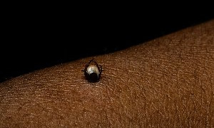 Ezber bozan uyarı: Önce keneyi çıkartın sonra hastaneye gidin