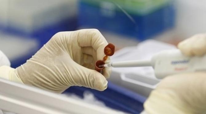 Şarbon nedir? Şarbon hastalığının belirtileri ve tedavisi. Şarbon hastalığı nasıl bulaşır?