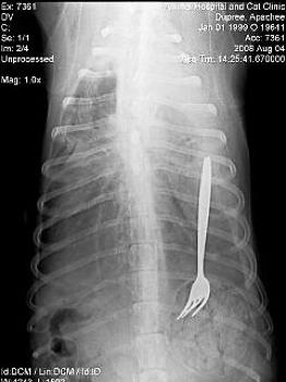 Şoke eden röntgen filmleri galerisi resim 15