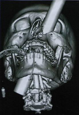 Şoke eden röntgen filmleri galerisi resim 20