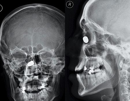 Şoke eden röntgen filmleri galerisi resim 6
