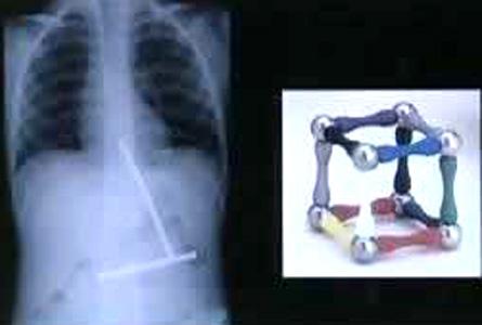Şoke eden röntgen filmleri galerisi resim 8