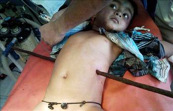 En ilginç tıbbi vakalar! galerisi resim 3