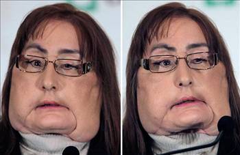 En ilginç tıbbi vakalar! galerisi resim 7