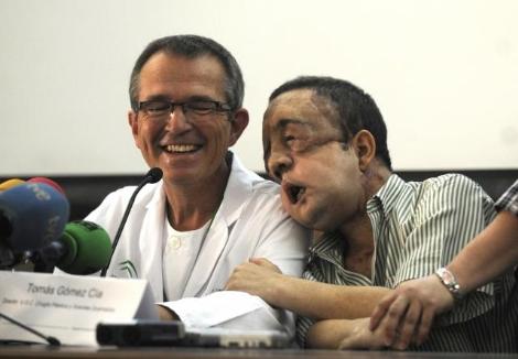 İşte tam yüz nakli yapılan hasta galerisi resim 3