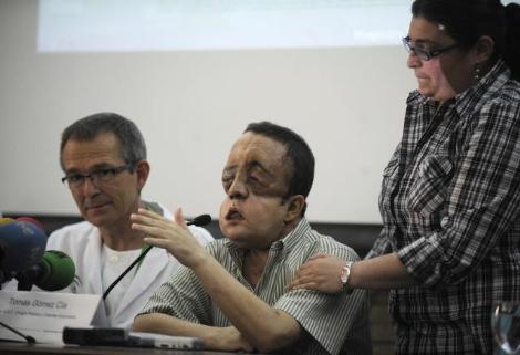 İşte tam yüz nakli yapılan hasta galerisi resim 4