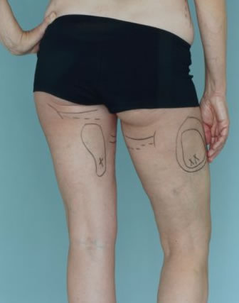 Kadınların gözüyle estetikte ilk on galerisi resim 8