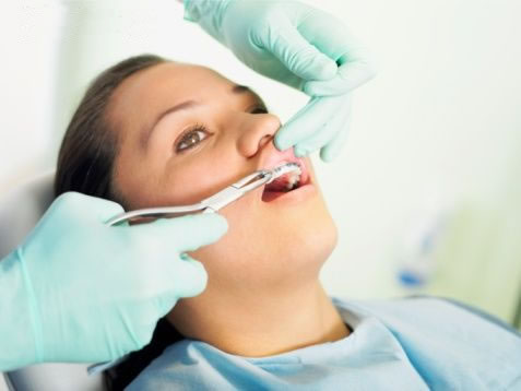 İşte dişleri beyazlatmanın 10 kuralı! galerisi resim 9