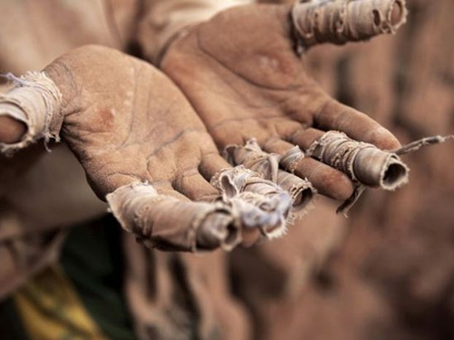 Bir parça ekmek için ölüyorlar galerisi resim 11