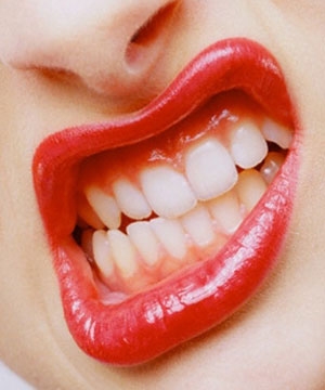 Dişler için faydalı 4 besin galerisi resim 6