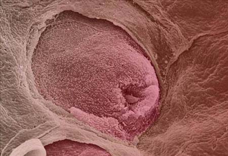 Vücudumuzdan 15 muhteşem görüntü galerisi resim 13