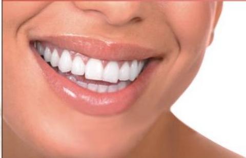 Diş bakımında 20 püf noktası galerisi resim 15