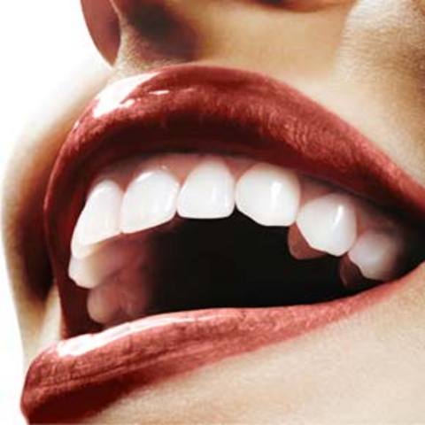 Diş bakımında 20 püf noktası galerisi resim 18