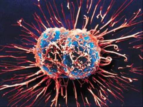 Kanserin sekiz belirtisi galerisi resim 4