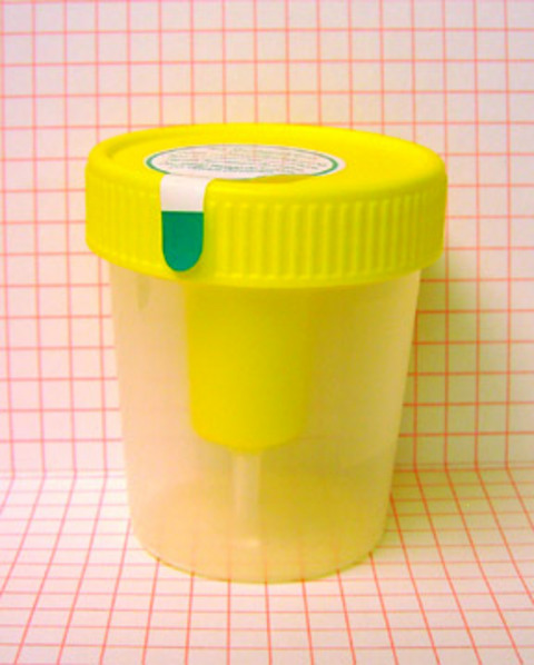 Kanserin sekiz belirtisi galerisi resim 7