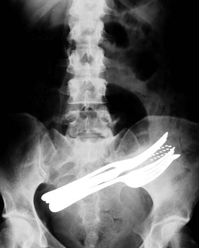 Bu röntgenler gerçek! galerisi resim 1