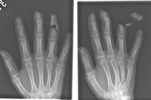 Bu röntgenler gerçek! galerisi resim 10