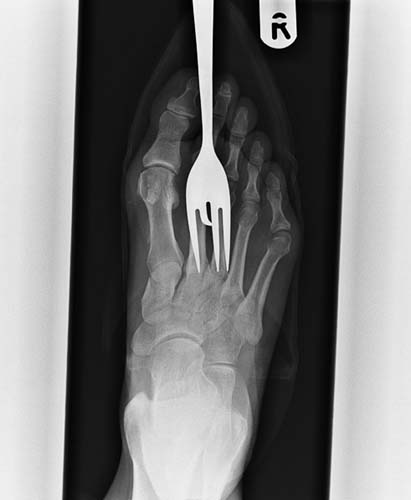 Bu röntgenler gerçek! galerisi resim 11