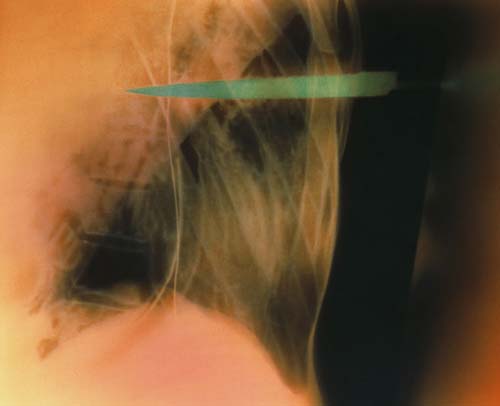 Bu röntgenler gerçek! galerisi resim 12