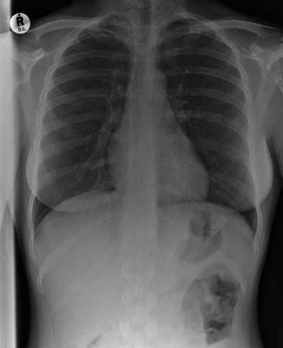 Bu röntgenler gerçek! galerisi resim 14