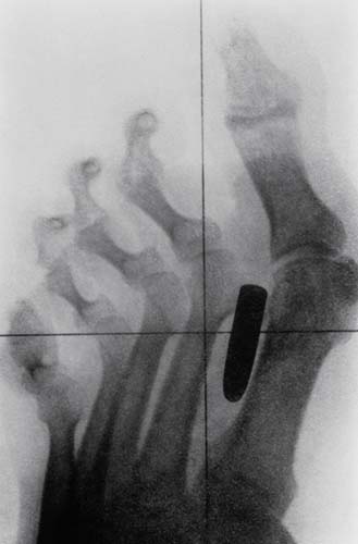 Bu röntgenler gerçek! galerisi resim 2