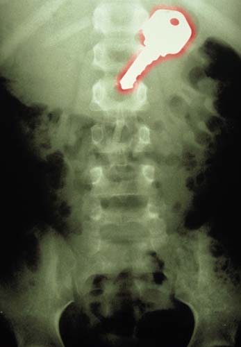 Bu röntgenler gerçek! galerisi resim 4