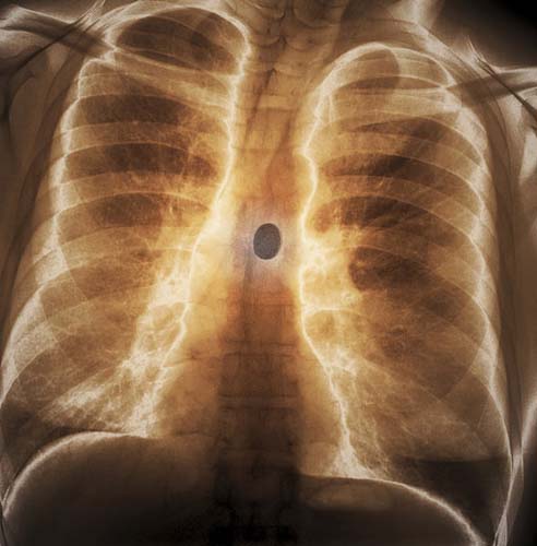 Bu röntgenler gerçek! galerisi resim 7