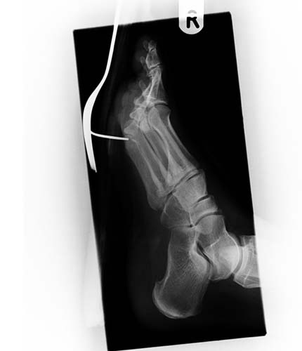 Bu röntgenler gerçek! galerisi resim 8