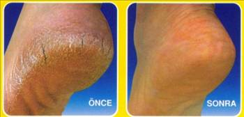 Basit ama işe yarayan sağlık tavsiyesi galerisi resim 14