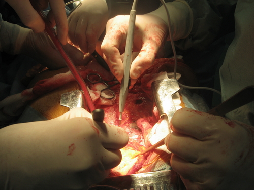 Organ naklinde neler dönüyor? galerisi resim 5