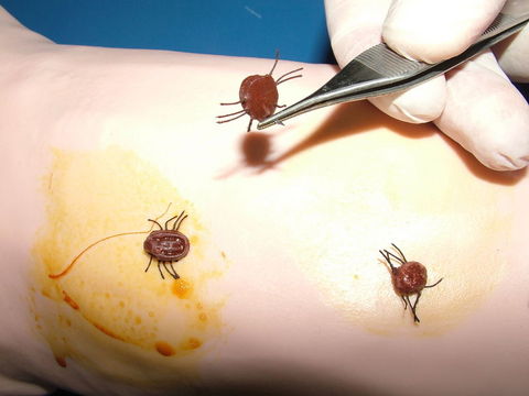 En tehlikeli liste! galerisi resim 3