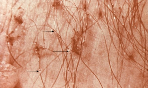 En tehlikeli liste! galerisi resim 6