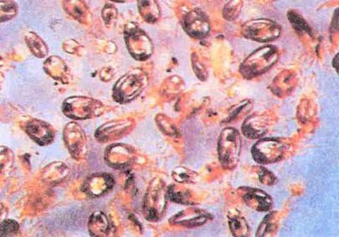 En tehlikeli liste! galerisi resim 7