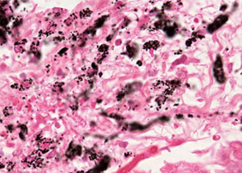 En tehlikeli liste! galerisi resim 9