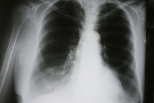 Sigaranın 4 bin yıllık serüveni galerisi resim 9