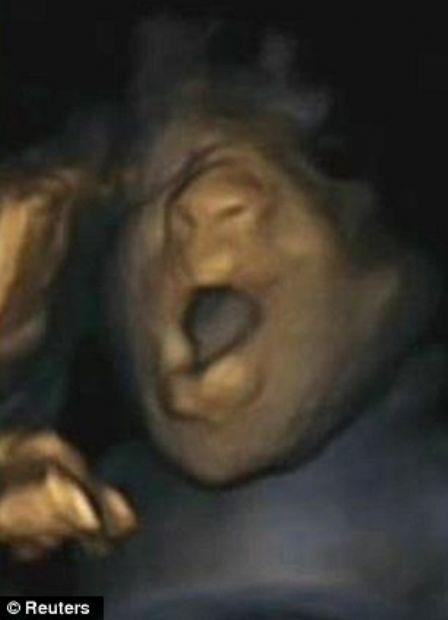 Bebeğin esneme anı galerisi resim 1