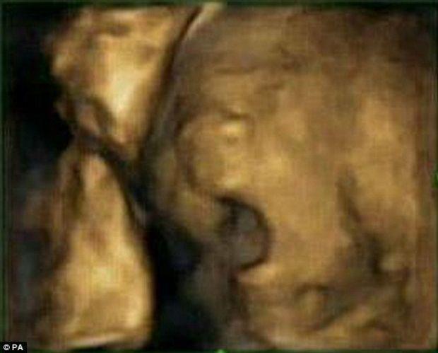 Bebeğin esneme anı galerisi resim 2