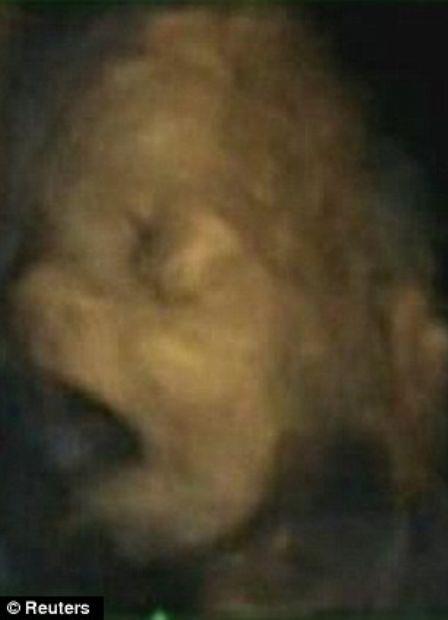 Bebeğin esneme anı galerisi resim 3