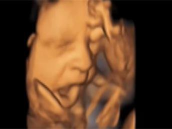 Bebeğin esneme anı galerisi resim 5