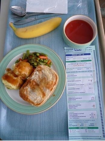 Dünyanın 18 farklı ülkesinden 18 hastane yemeği galerisi resim 16