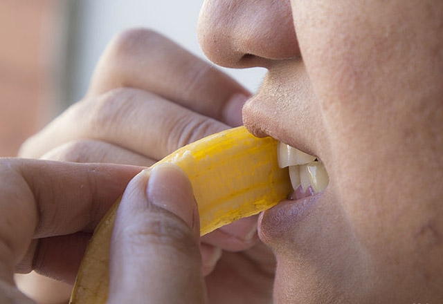 Dişleri beyazlatmanın 5 yolu galerisi resim 1