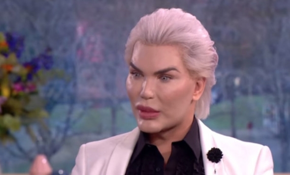 Bu defa şoke etti! Zayıflamak için bakın ne içiyormuş galerisi resim 11