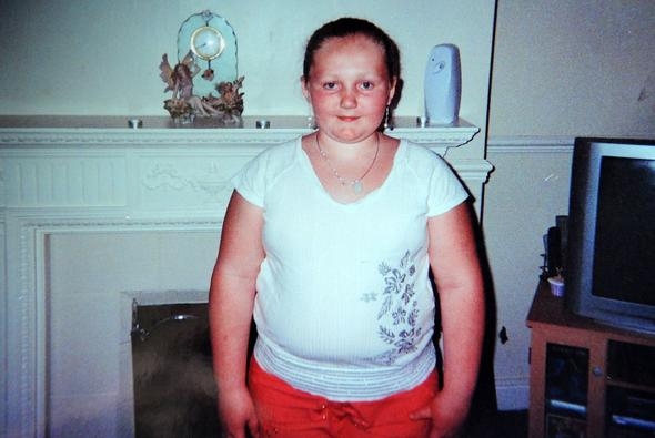 Diyabet tedavisini reddeden 20 yaşındaki Natasha yaşamını yitirdi galerisi resim 8