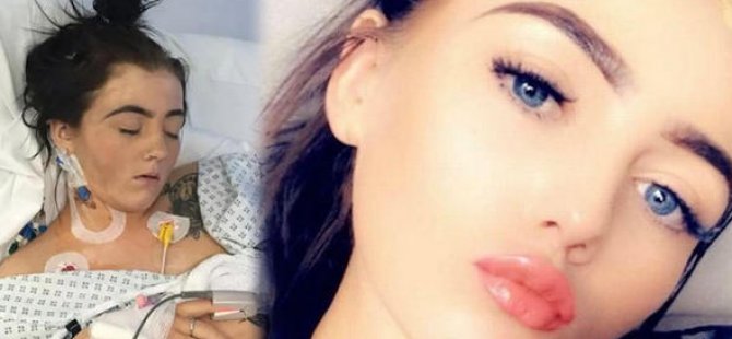 Diyabet tedavisini reddeden 20 yaşındaki Natasha yaşamını yitirdi