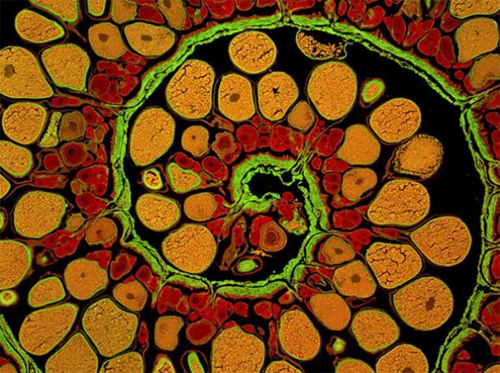 Mikroskobik dünyanın en iyi fotoğrafları galerisi resim 4