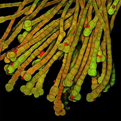 Mikroskobik dünyanın en iyi fotoğrafları galerisi resim 6