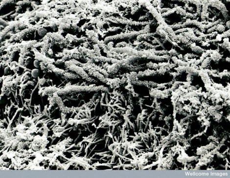 İnsan Vücudundan Görüntüler galerisi resim 7