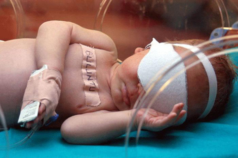 Bu fotoğraflar ödüllü galerisi resim 4