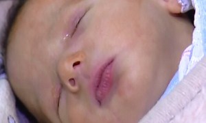 5 günlük bebeğe katarakt ameliyatı yapıldı
