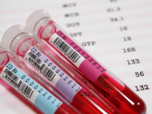 Tüm kanserler için tek test!